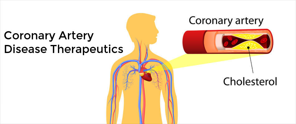 Coronary Artery Disease Therapeutics Market