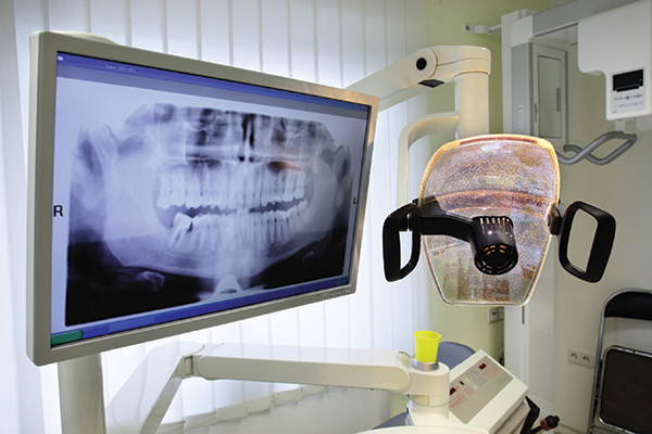 Dental intraoral X-ray sensors